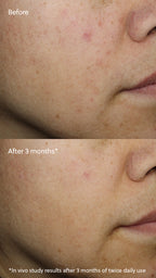 Eminence Vitamin C+ Serum